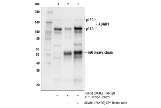 Immunoprecipitation Image 1: ADAR1 (E6X9R) XP<sup>®</sup> Rabbit mAb