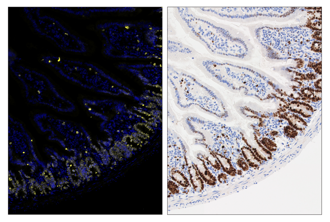 Immunohistochemistry Image 6: Ki-67 (D3B5) & CO-0052-647 SignalStar<sup>™</sup> Oligo-Antibody Pair