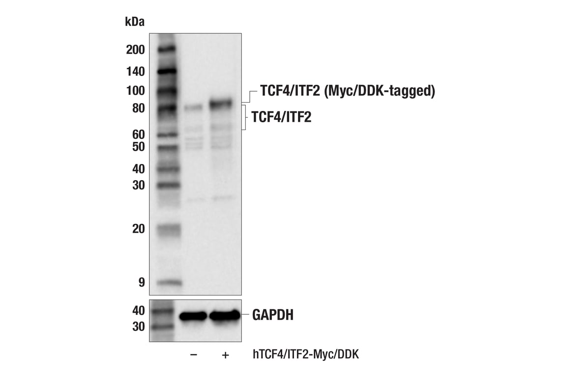 Western Blotting Image 3: TCF4/ITF2 (E3X2Y) Rabbit mAb