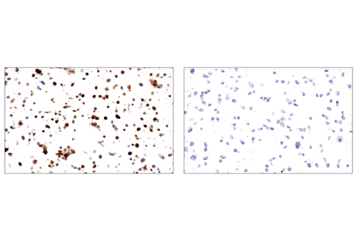 Immunohistochemistry Image 2: Cas9 (<i>S. pyogenes</i>) (E7M1H) XP<sup>®</sup> Rabbit mAb (BSA and Azide Free)