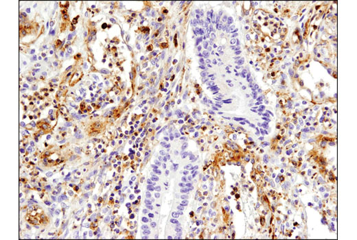 Immunohistochemistry Image 4: VISTA (D1L2G<sup>™</sup>) XP<sup>®</sup> Rabbit mAb (BSA and Azide Free)