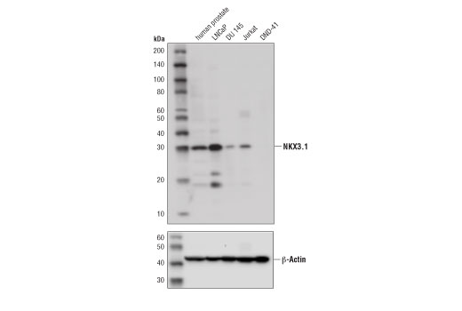 Western Blotting Image 1: NKX3.1 (D6D2Z) XP<sup>®</sup> Rabbit mAb