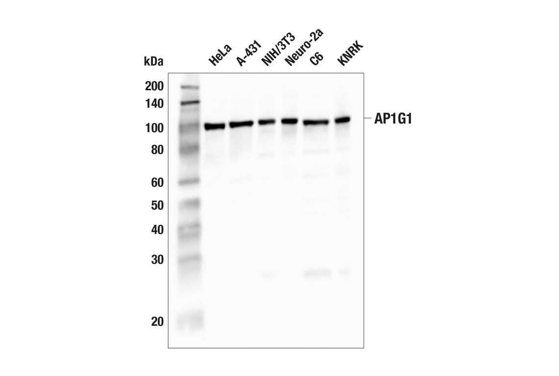 Western Blotting Image 1: AP1G1 (F2S8B) Rabbit mAb