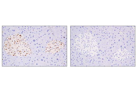 Immunohistochemistry Image 6: Cyclin D1 (E3P5S) XP<sup>®</sup> Rabbit mAb