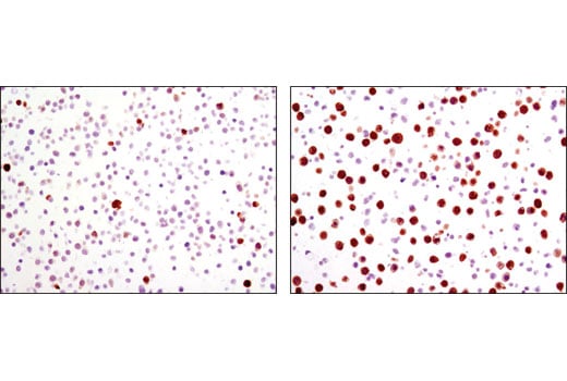 Immunohistochemistry Image 2: Phospho-Stathmin (Ser38) (D19H10) Rabbit mAb