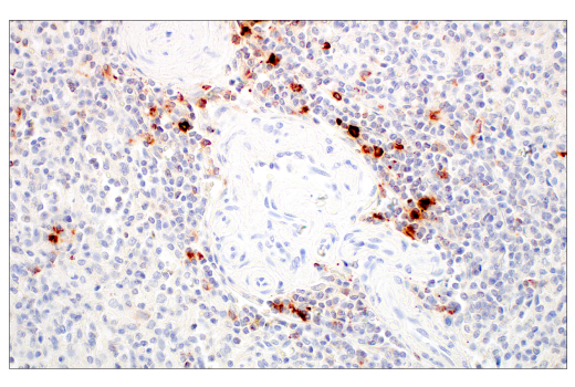 Immunohistochemistry Image 8: LAMP3/CD208 (E6E5U) XP<sup>®</sup> Rabbit mAb (BSA and Azide Free)