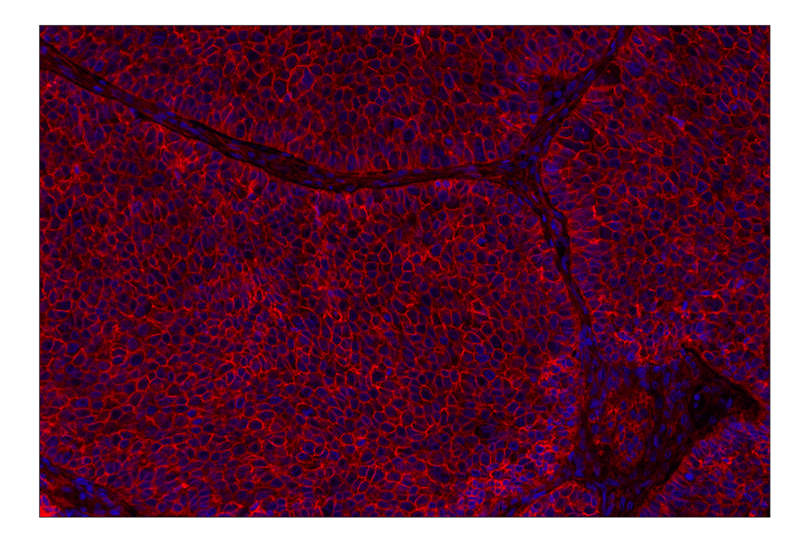 Immunohistochemistry Image 1: B7-H3 (D9M2L) XP<sup>®</sup> Rabbit mAb (Alexa Fluor<sup>®</sup> 647 Conjugate)