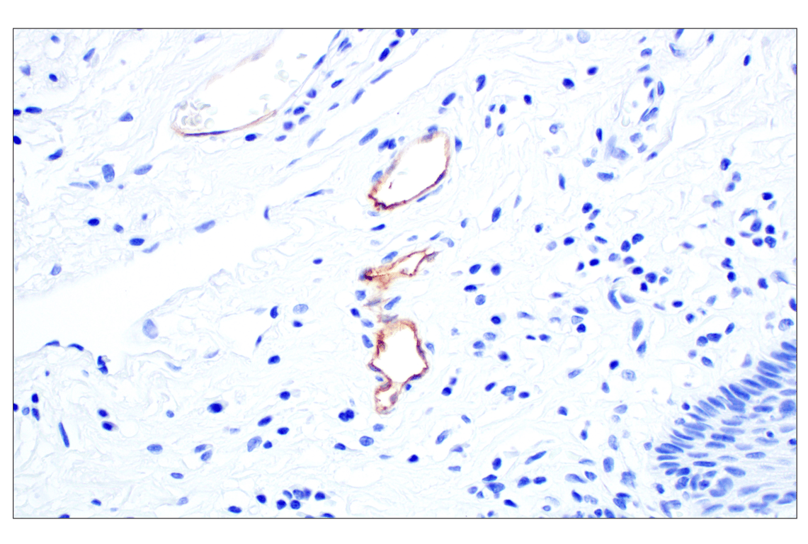 Immunohistochemistry Image 4: MAdCAM-1 (E1V8F) Rabbit mAb