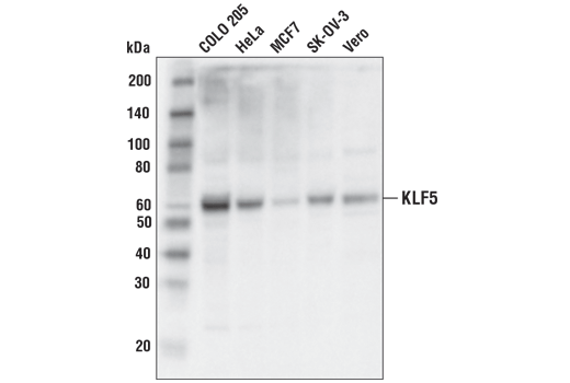 Western Blotting Image 1: KLF5 (D7S3F) Rabbit mAb