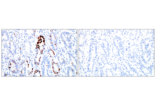 Immunohistochemistry Image 9: MAGE-C2/CT10 (E7B8D) XP<sup>®</sup> Rabbit mAb