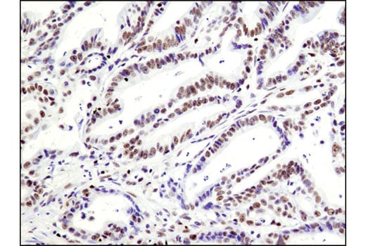 Immunohistochemistry Image 1: RBPSUH (D10A4) XP<sup>®</sup> Rabbit mAb