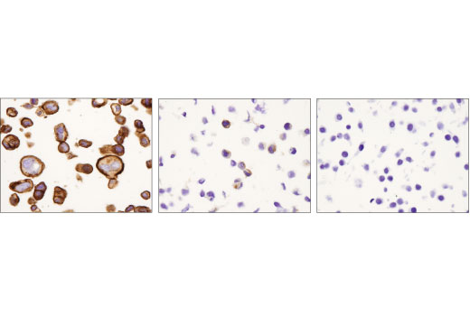 Immunohistochemistry Image 4: FGF Receptor 2 (D4L2V) Rabbit mAb (BSA and Azide Free)