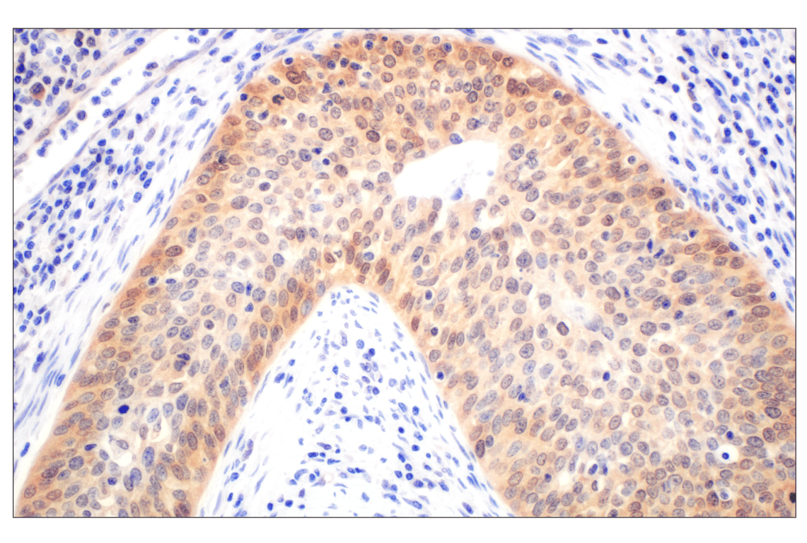 Immunohistochemistry Image 2: Galectin-8/LGALS8 (F9O3T) Rabbit mAb