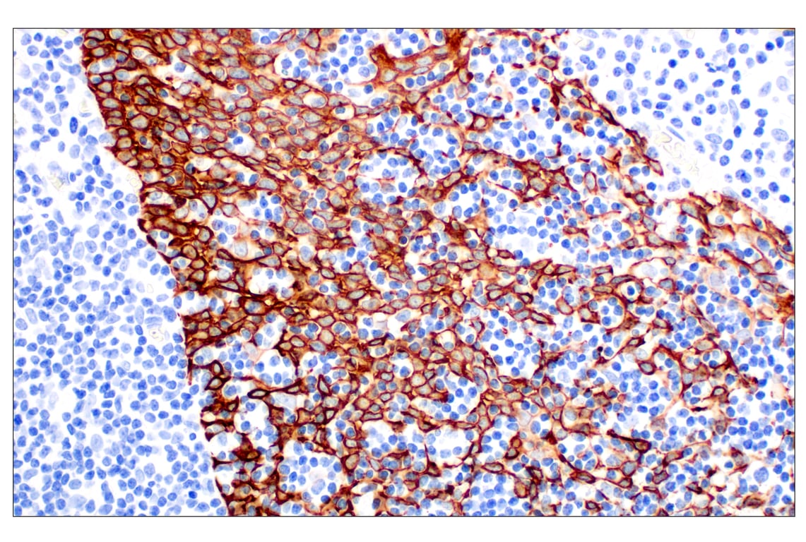 Immunohistochemistry Image 5: Keratin 14 (E7W6V) Rabbit mAb