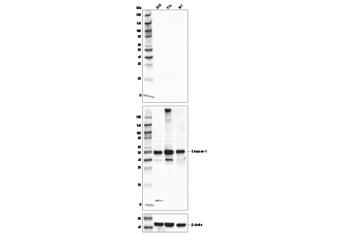 undefined Image 20: Mouse Reactive Pyroptosis Antibody Sampler Kit