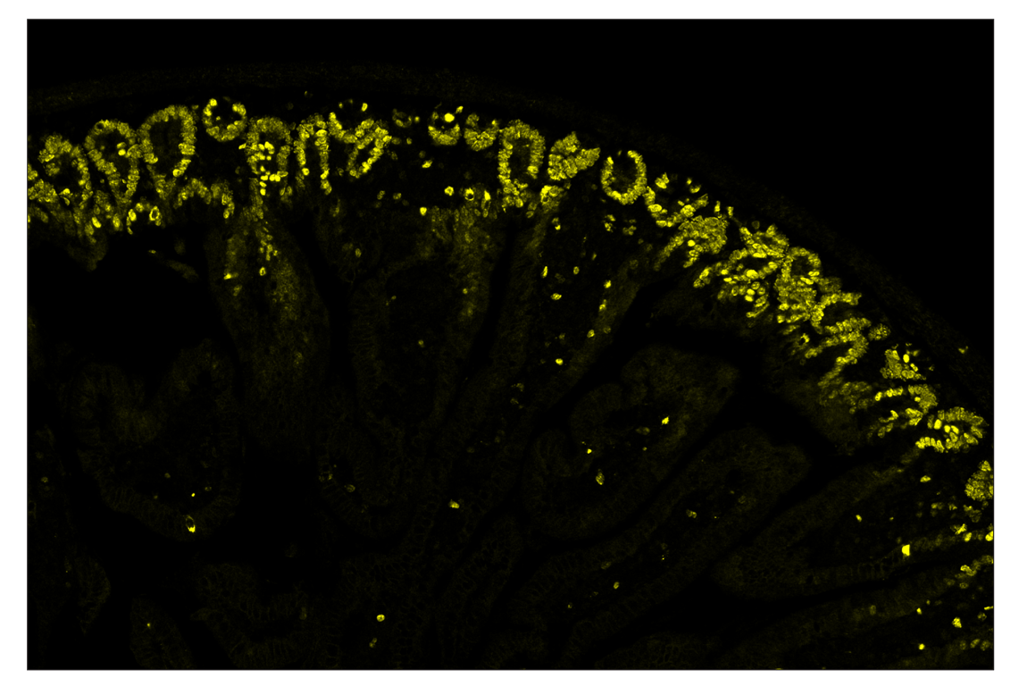 Immunohistochemistry Image 3: Ki-67 (D3B5) & CO-0052-488 SignalStar<sup>™</sup> Oligo-Antibody Pair