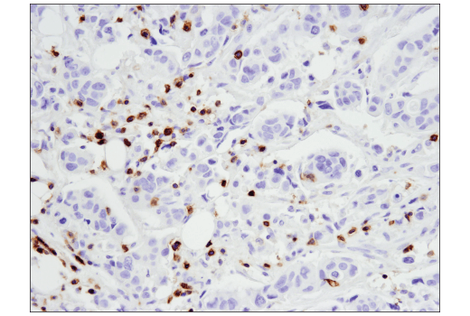 Immunohistochemistry Image 1: CD5 (E8X3S) XP<sup>®</sup> Rabbit mAb