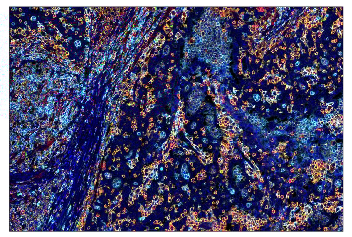 Immunohistochemistry Image 7: CD16 (D1N9L) & CO-0031-488 SignalStar<sup>™</sup> Oligo-Antibody Pair