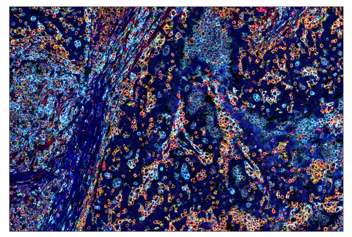 Immunohistochemistry Image 7: CD16 (D1N9L) & CO-0031-594 SignalStar<sup>™</sup> Oligo-Antibody Pair