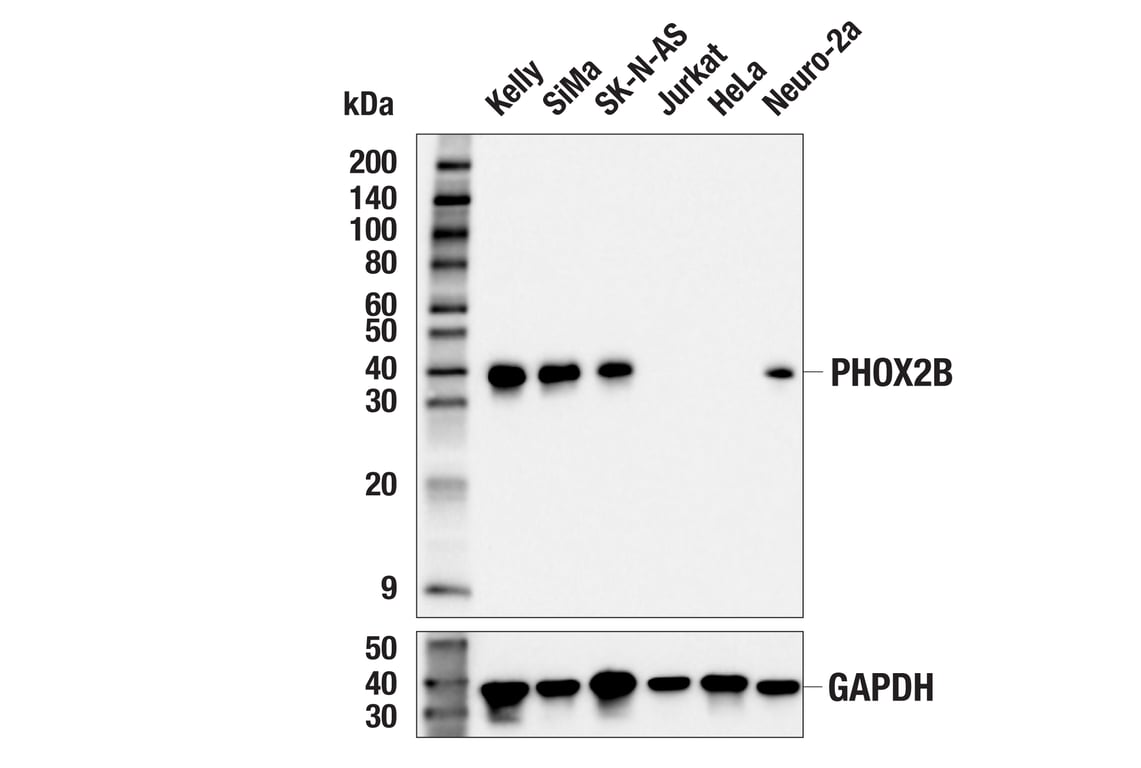 Western Blotting Image 1: PHOX2B (E4Q9R) Rabbit mAb