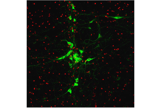 Immunofluorescence Image 1: TPH2 (D3E5I) XP<sup>®</sup> Rabbit mAb