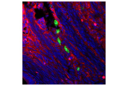 Immunofluorescence Image 1: Granzyme B (D2H2F) Rabbit mAb (BSA and Azide Free)