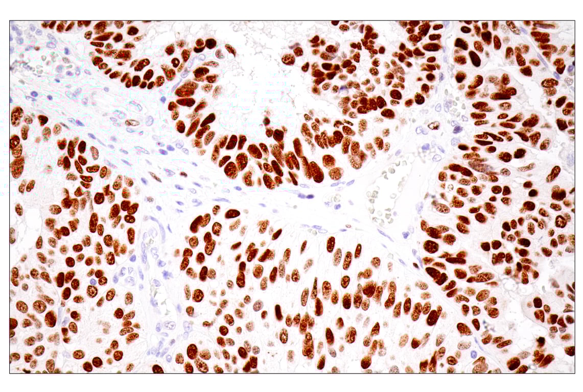 Immunohistochemistry Image 1: UHRF1 (E5W8W) Rabbit mAb