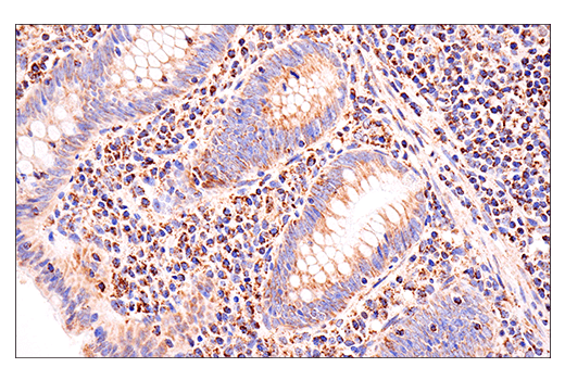 undefined Image 17: Glutamine Metabolism Antibody Sampler Kit