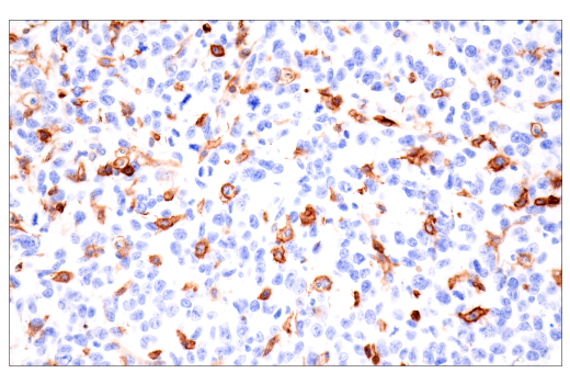 Immunohistochemistry Image 3: CD38 (E9F5A) XP<sup>®</sup> Rabbit mAb