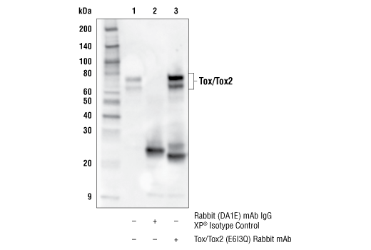 undefined Image 29: Human Exhausted CD8<sup>+</sup> T Cell IHC Antibody Sampler Kit