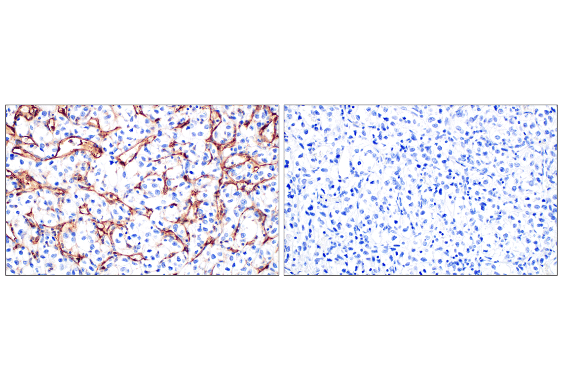 Immunohistochemistry Image 13: CD31 (PECAM-1) (F8M3S) Rabbit mAb (BSA and Azide Free)