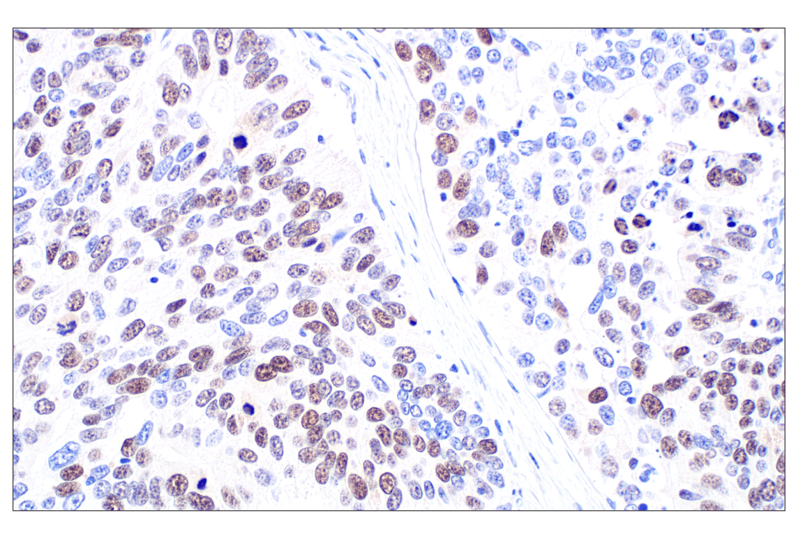 Immunohistochemistry Image 1: MASTL (F7I2C) Rabbit mAb