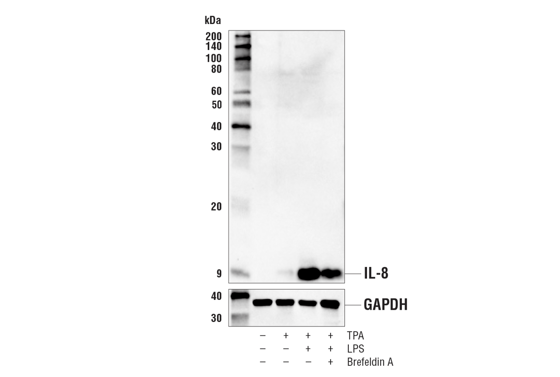 Western Blotting Image 2: IL-8 (E5F5Q) XP<sup>®</sup> Rabbit mAb (BSA and Azide Free)