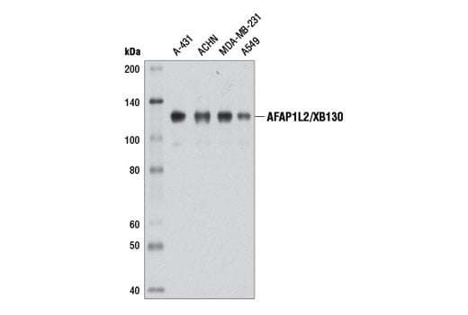 Western Blotting Image 1: AFAP1L2/XB130 (D4A5) Rabbit mAb