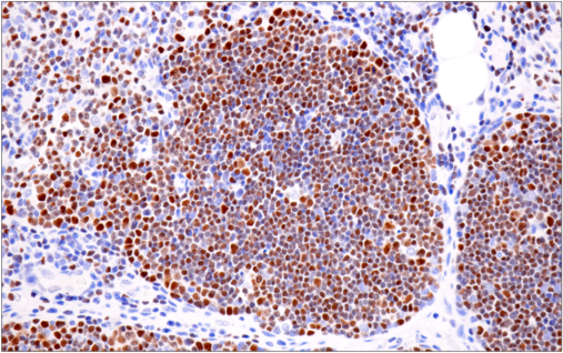 使用 CD19 (Intracellular Domain) (D4V4B) XP<sup>®</sup> Rabbit mAb 对石蜡包埋的人扁桃体细胞进行免疫组织化学分析。