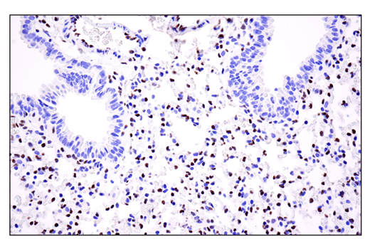 Immunohistochemistry Image 5: ZEB1 (E2G6Y) XP<sup>®</sup> Rabbit mAb (BSA and Azide Free)