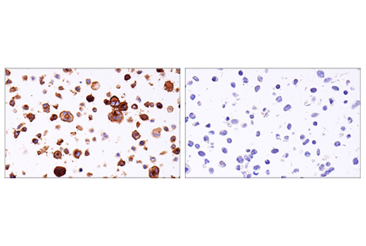 Immunohistochemistry Image 1: 4-1BB/CD137/TNFRSF9 (E6Z7F) XP<sup>®</sup> Rabbit mAb (BSA and Azide Free)