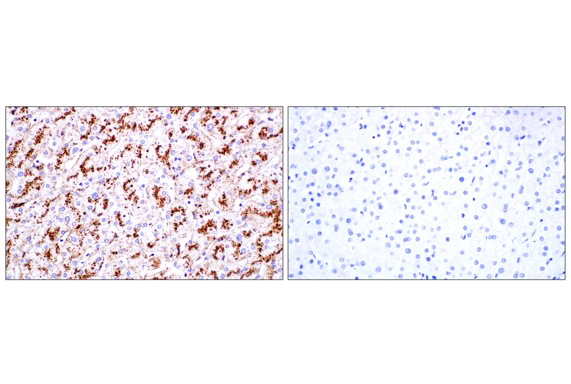 Immunohistochemistry Image 13: Cathepsin D (E5V4H) Rabbit mAb