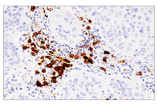 Immunohistochemistry Image 1: CD38 (E7Z8C) XP<sup>®</sup> Rabbit mAb