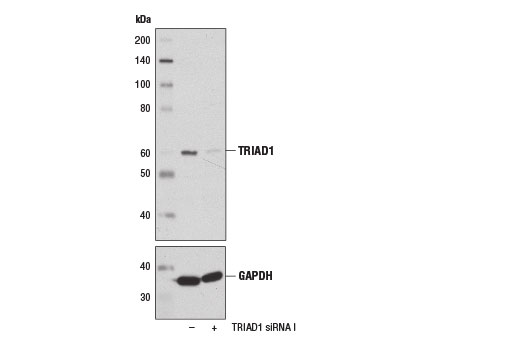 Western Blotting Image 1: TRIAD1 Antibody