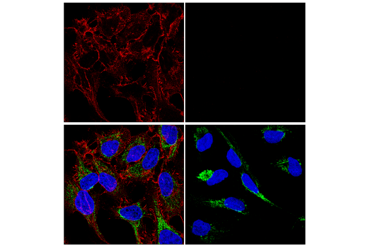 Immunofluorescence Image 1: β-Catenin (D10A8) XP<sup>®</sup> Rabbit mAb (Alexa Fluor<sup>®</sup> 555 Conjugate)