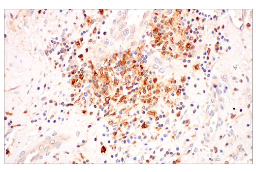 Immunohistochemistry Image 6: c-Rel (E8Z5Y) XP<sup>®</sup> Rabbit mAb (BSA and Azide Free)