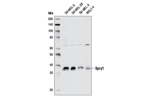 Western Blotting Image 1: Spry1 (D9V6I) Rabbit mAb