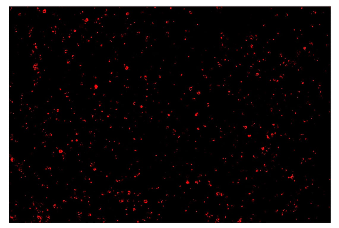 Immunohistochemistry Image 4: LAG3 (D2G4O<sup>™</sup>) & CO-0026-594 SignalStar<sup>™</sup> Oligo-Antibody Pair