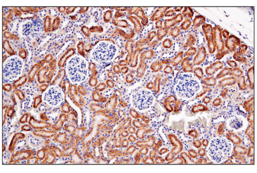 Immunohistochemistry Image 4: Semaphorin-4D/CD100 (E5C3B) XP<sup>®</sup> Rabbit mAb