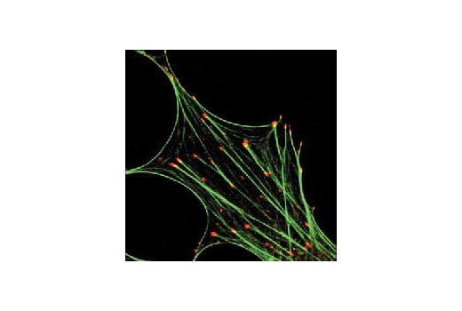 Immunofluorescence Image 1: Phospho-Tyrosine Mouse mAb (P-Tyr-100)