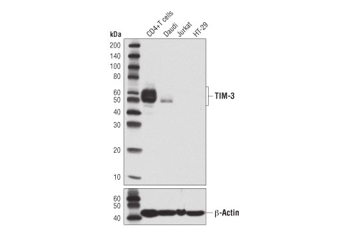 undefined Image 6: Human Exhausted CD8<sup>+</sup> T Cell IHC Antibody Sampler Kit