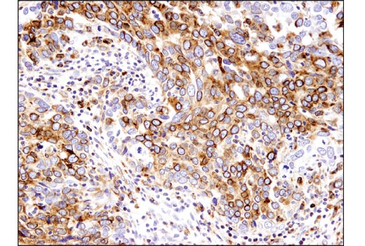 Immunohistochemistry Image 1: CD74 (D5N3I) XP<sup>®</sup> Rabbit mAb