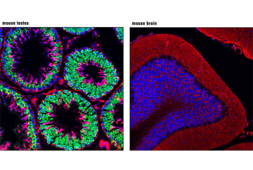 Immunofluorescence Image 1: DDX4 (D10C5) Rabbit mAb
