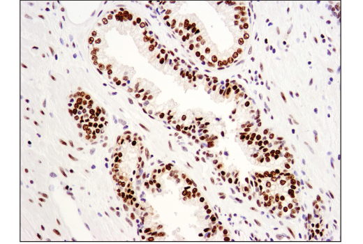 undefined Image 44: BAF Complex IHC Antibody Sampler Kit